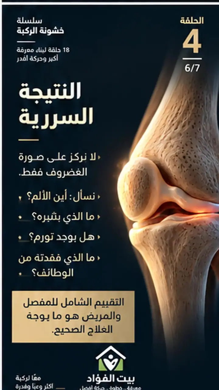 الشريحة 6 من 7: الألم في خشونة الركبة