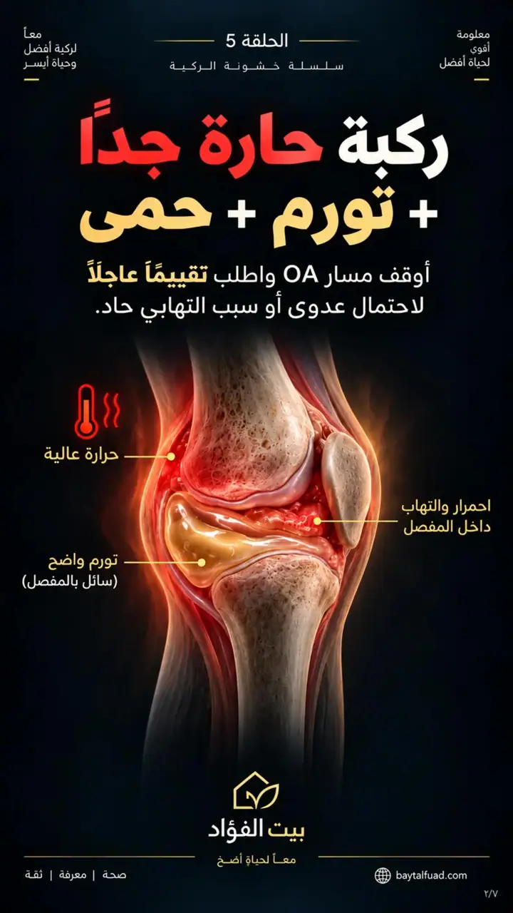 الشريحة 2 من 7: سلسلة خشونة الركبة