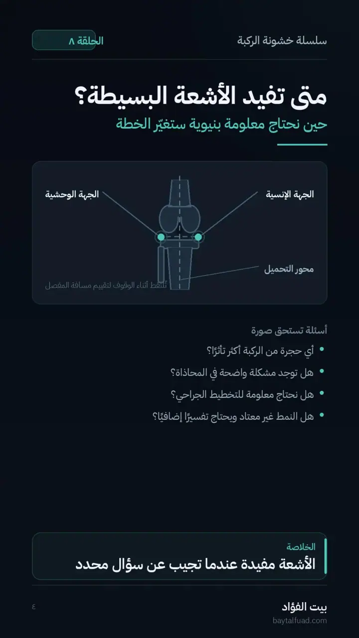 الشريحة 4 من 7: هل نحتاج الأشعة أو الرنين؟ (خشونة الركبة)